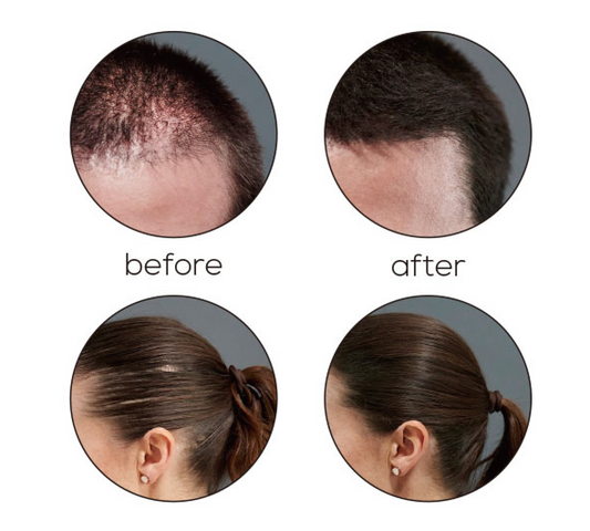 Starhaire Hair Fiber 27.5g